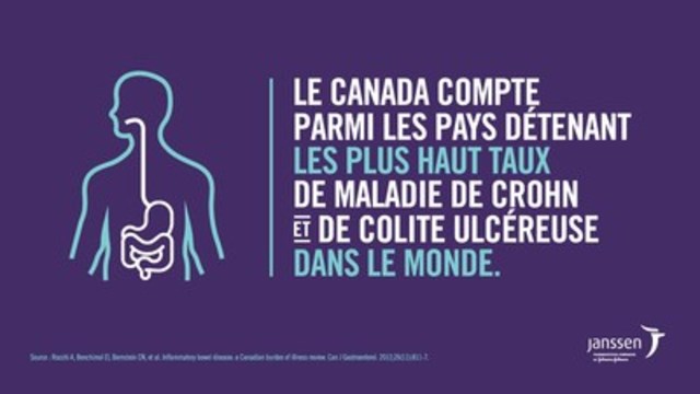 Santé Canada approuve STELARA® pour le traitement de la maladie de crohn de sévérité modérée à élevée chez les adultes