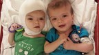 Separate But Together: Formerly Conjoined Twins Jadon and Anias McDonald Move On To The Next Chapter Of Recovery