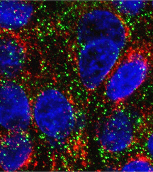 Coping Mechanism Suggests New Way to Make Cancer Cells More Vulnerable to Chemotherapies