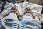 Mizuho OSI's Insite® Specialty Surgical Table Proved Vital in the Separation of 12-month-old Conjoined Twin Girls