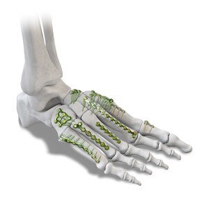 Paragon 28 announces launch of unprecedented small bone fixation system for foot &amp; ankle-Baby Gorilla Mini Plating System