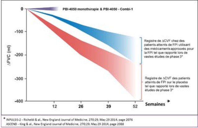 Le PBI-4050 de ProMetic continue de démontrer des premiers signes d'efficacité suite à l'achèvement de l'étude clinique de phase 2 sur la fibrose pulmonaire idiopathique