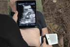 Clarius Mobile Health and North American Rescue Inks Deal to Distribute Rugged, Wireless Ultrasound to US Federal Government Agencies