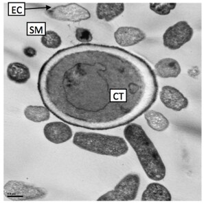 First probiotic to address the critical role of fungi in digestive health hits market