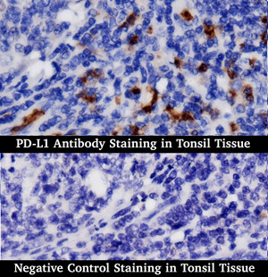 BioGenex Introduces PD1 and PDL-1 Antibodies for Immunohistochemistry (IHC)