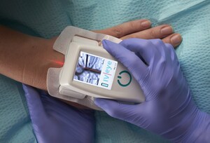 CorVascular and Novarix Enter into Distribution Agreement for Vein Imaging Devices