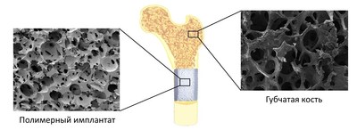 The structure of implants created from Ultra-high molecular weight polyethylene is identical bone-s structure (PRNewsFoto/NUST MISIS)