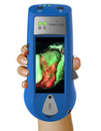 Smith &amp; Nephew signs exclusive worldwide distribution agreement for the revolutionary MolecuLight i:X™ imaging device