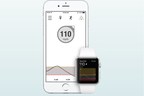 Dexcom G5® Mobile Continuous Glucose Monitoring (CGM) System now Compatible[1] with Apple Watches in Europe