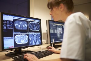 Philips Showcases Radiation Oncology Innovations at ESTRO 36, to Enhance Precision and Reduce Time to Treatment, From Imaging to Planning