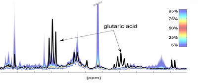 1H NMR spectrum of urine - comparison of individual spectral fingerprint (black) to reference ranges from a healthy population demonstrating a case of significant deviation. (PRNewsfoto/Bruker Corporation)