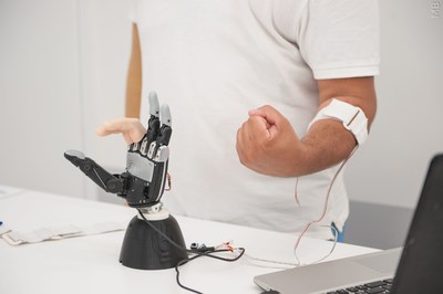 Electronic bionic prosthesis of human hand Maxbionics (PRNewsfoto/NUST MISIS)