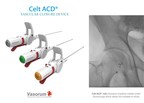 Vasorum Launches Celt ACD® Second Generation Vascular Closure Device in the USA