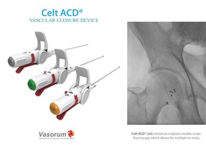 Vasorum Launches Celt ACD® Second Generation Vascular Closure Device in the USA