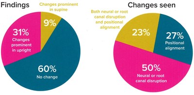 Evidence of changes in weight-bearing acquisitions and correlated pathologies (PRNewsfoto/Paramed Medical Systems)