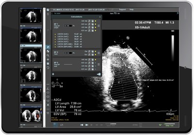 In the Studycast zero-footprint viewer, you can take measurements and generate calculations right in your browser - and then save them to the study's report. View, document, and report from anywhere with an Internet connection.