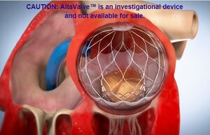 AltaValve™, 4C Medical's Novel Transcatheter Mitral Regurgitation Device Highlighted at TCT 2019