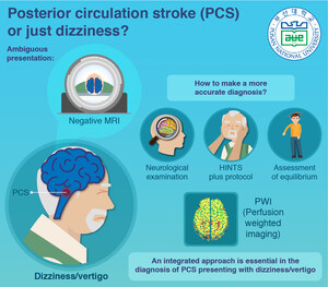 "Normal" MRI Scan Accompanied by Dizziness--Warning Sign of Posterior Stroke, Says Pusan University Scientists