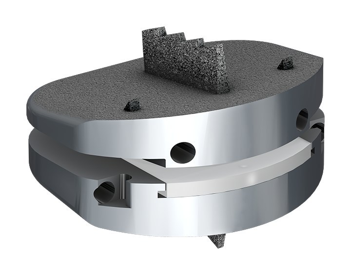 Centinel Spine® Celebrates 18 Years of Usage of prodisc® L Total Disc Replacement in the U.S.