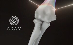 Affordable 3D-Printed Bones on the Edge of Mass Adoption, Thanks to ADAM