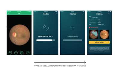 Retinal_Cameras_Remidio_Innovative Retinal_Cameras_Remidio_Innovative