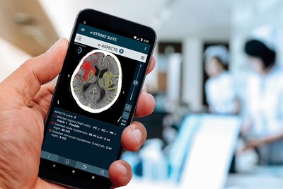 Brainomix’s AI-Driven Software Gives Doctors Reliable Information to Treat Stroke Patients (PRNewsfoto/Brainomix)