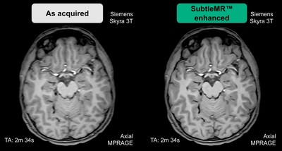 Subtle Medical Receives FDA 510(k) Clearance for AI-Powered SubtleMR Subtle Medical Receives FDA 510(k) Clearance for AI-Powered SubtleMR