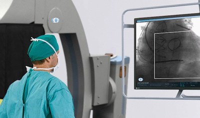 Omega Medical Imaging First in the World to Receive FDA Clearance