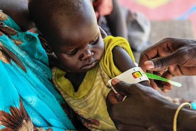A child is screened for malnutrition at one of Action Against Hunger's health centers in South Sudan. Photo: Lys Arango for Action Against Hunger. (PRNewsfoto/Action Against Hunger)