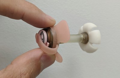 Fidmi Medical’s low-profile PEG tube for easier insertion, replacement and comfort Fidmi Medical’s low-profile PEG tube for easier insertion, replacement and comfort