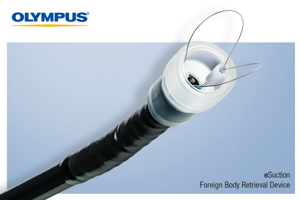 Olympus is the exclusive U.S. distributor of eSuction from EndoTherapeutics, which combines snare technology with suction to aid in the retrieval of food bolus impactions, foreign bodies and excised tissue such as polyps.