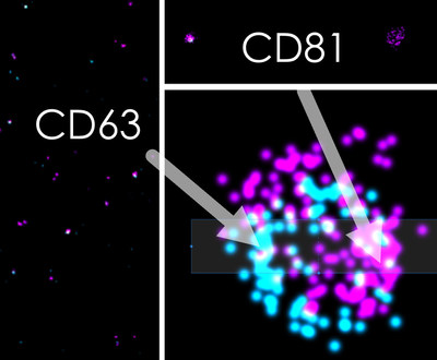 The first light based image in the world of an Exosome using novel dSTORM fluorescence microscopy techniques as employed by Kimera Labs The first light based image in the world of an Exosome using novel dSTORM fluorescence microscopy techniques as employed by Kimera Labs