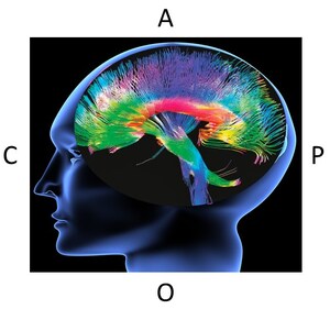 Unique Alzheimer's Disease Tau Vaccine Shows Great Potential in Pre-Clinical Studies