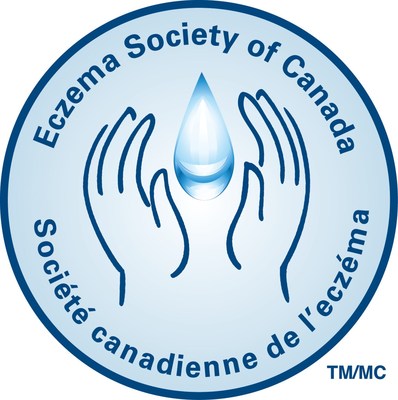 Socit canadienne de l'eczma (Groupe CNW/Socit canadienne de l'eczma)