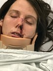 NEW JERSEY: "A Woman was Brutally Attacked by a Police Sergeant and then Charged with Aggravated Assault by the Police Department"
