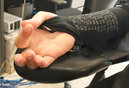 An over-the-skin bioelectronic sleeve used to help individuals with paralysis move their fingers.