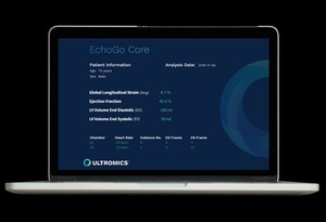 Ultromics Receives FDA Clearance for its AI-powered Decision Support System, EchoGo Core