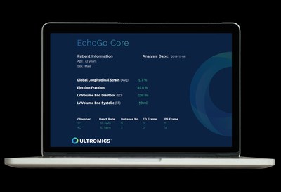 Report generated for the clinician by EchoGo AI