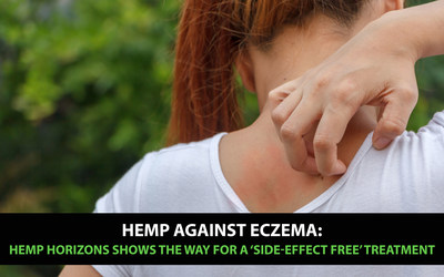 Hemp against Eczema: Hemp Horizons shows the way for a ‘side-effect free’ treatment