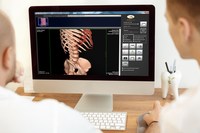 Nautilus Medical's MatrixRay Viewer and tools for secure exchange of patient images and data.