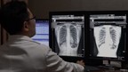 Lunit annonce l'obtention de son premier label CE pour Lunit INSIGHT CXR, logiciel IA d'analyse de radiographies thoraciques