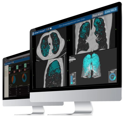 XStream® aiCockpit™ and XStream® aiPlatform™ by Fovia Ai. Visualization and Workflow Orchestration for Artificial Intelligence, RSNA 2019.