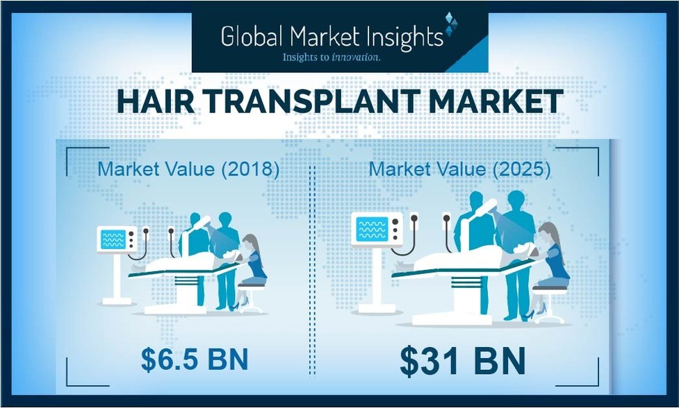 Hair Transplant Market to Hit $31 Billion by 2025: Global Market Insights,  Inc.