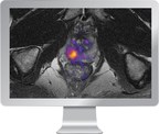 HealthLytix Receives FDA Clearance for Breakthrough Prostate Imaging Solution, RSI-MRI+