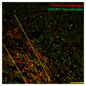 Stem Cell Therapy Helps Broken Hearts Heal in Unexpected Way