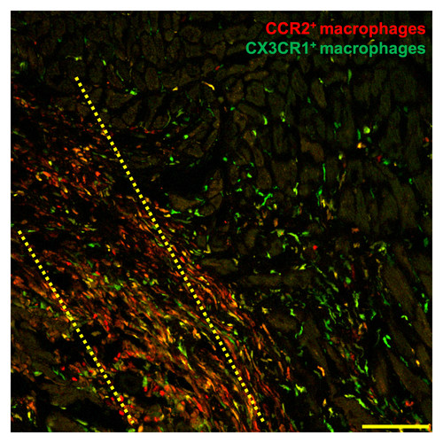 In this microscopic histology image, macrophage immune cells (shown in red and green) flock to the injured region of a damaged mouse heart three days after researchers injected adult heart stem cells within the yellow dotted area. Researchers report Nov. 27 in Nature that stem cell therapy helps hearts recover from heart attack by triggering an innate immune response that alters cell activity around the injured area so that it heals with a more optimized scar and improved contractile properties.