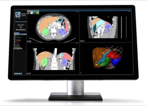 Together with NVIDIA CLARA, Fovia Ai Brings AI Annotation Tools to Physicians Everywhere