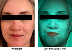 MDR Aesthetics Launches dermID, a Novel Skin Imaging Device to Aid in Visualizing Skin Conditions that Cannot be Seen with the Naked Eye