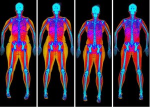 Bodyscan Unveils New Fat-loss Calorie Calculator