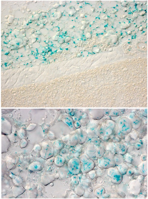 These images show expression of the OPN3 gene (in blue) in white fat cells of mice in two locations. The upper panel shows interscapular white adipocytes (above a layer of muscle and above brown adipose tissue). The lower panel shows white adipocytes from the inguinal adipose depot. This data is part of a study led by scientists at Cincinnati Children's, published Jan. 21, 2020, in Cell Reports, indicating that fat cells deep under the skin respond directly to light exposure.